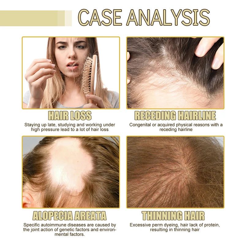 EELHOE Dense Hair Essential Oil Repairs Hair Damage Prevents Hair Loss Softens Nourishes Hair Nourishes Hair Essence Oil Health