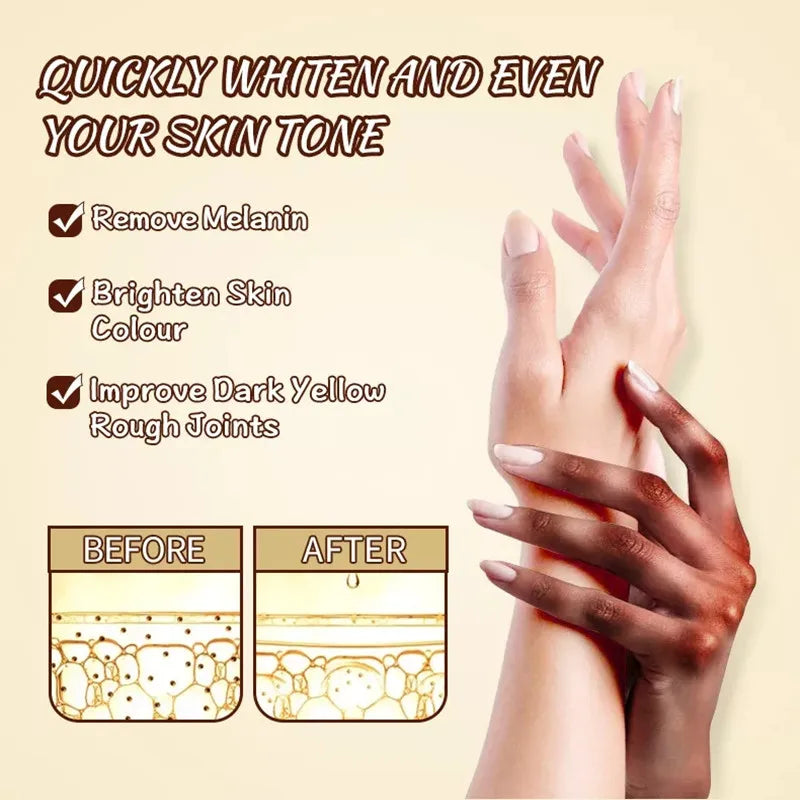 Dark Knuckles Fast Whitening Serum Pigmentation Correctors for Black Skin Hand