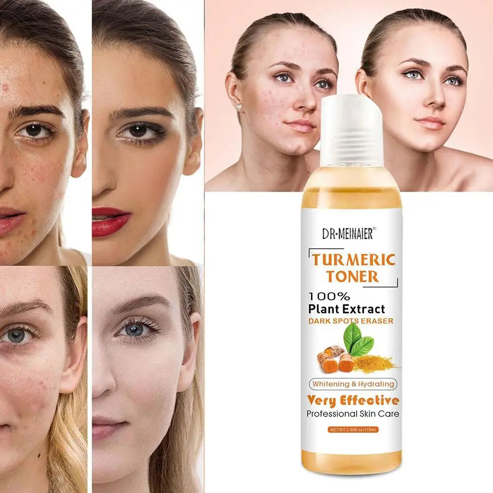 Turmeric Face Serum Whitening Dark Spot Remover Acne Scar Bright Skin Corrector Facial