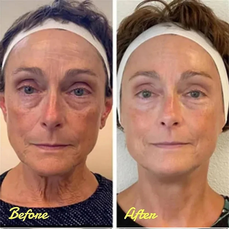 Cëlyn Make Up Eye Firmer Eye Lift Firm Eye Bag Removal Wrinkle Removal Eye Care Eye Cream Remover Dark Circle Eye Pouches
