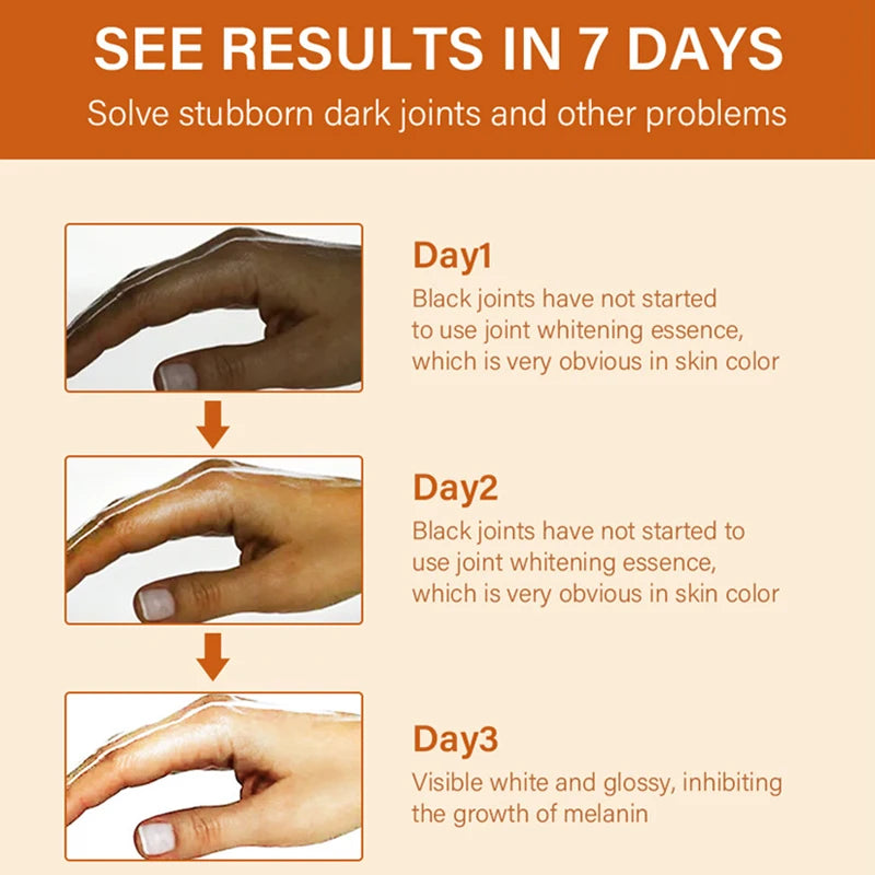 Dark Knuckles Fast Whitening Serum Pigmentation Correctors for Black Skin Hand