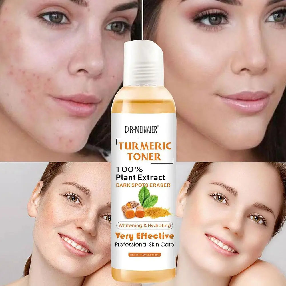 Turmeric Face Serum Whitening Dark Spot Remover Acne Scar Bright Skin Corrector Facial