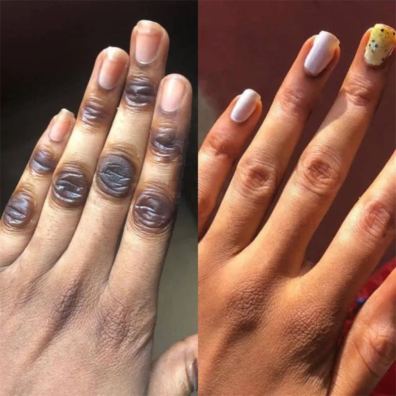 Dark Knuckles Fast Whitening Serum Pigmentation Correctors for Black Skin Hand