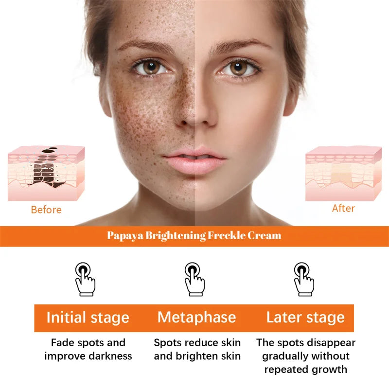 Freckles Removal Papaya Day Night Cream