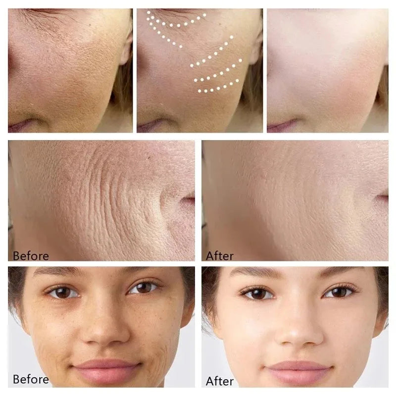 Retinol Wrinkle Removing Cream Fade Fine Lines Anti Aging Firming Lifting Moisturizing Brightening Skin Care Korean Cosmetics