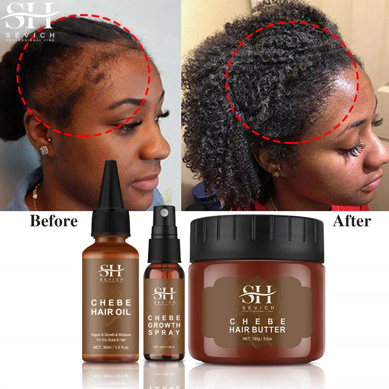 All Chebe Product Crazy Hair Growth Oil African Traction Alopecia Chebe Powder Serum Edges