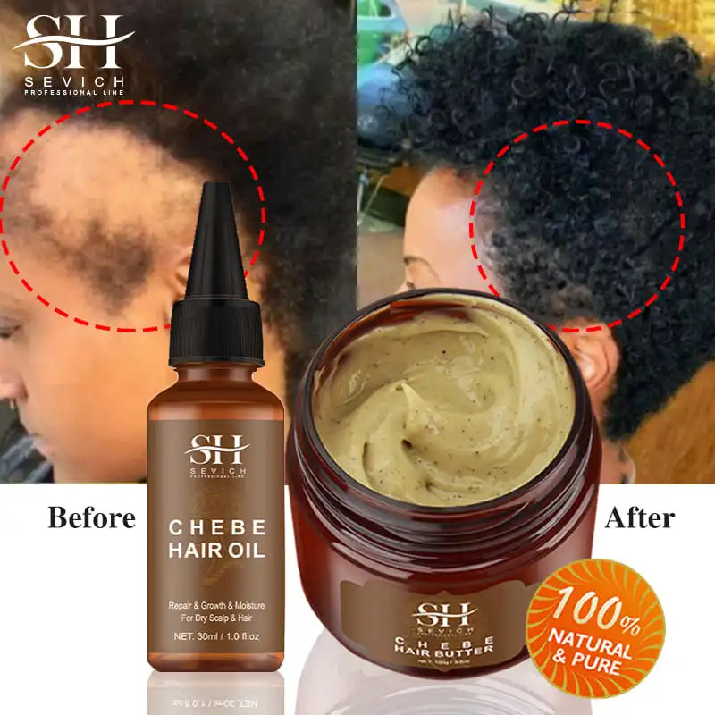 All Chebe Product Crazy Hair Growth Oil African Traction Alopecia Chebe Powder Serum Edges