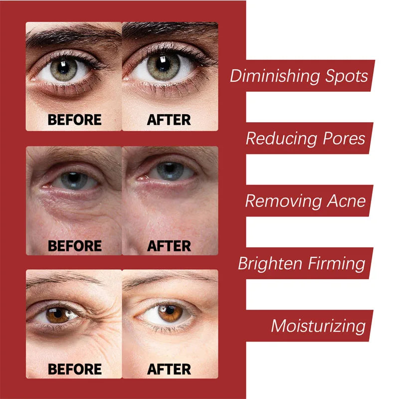 Retinol Wrinkle Removing Cream Fade Fine Lines Anti Aging Firming Lifting Moisturizing Brightening Skin Care Korean Cosmetics