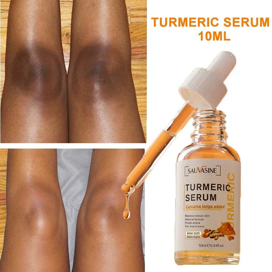 Turmeric Serum Freckle Whitening Fade Dark Spots Removal Pigment Melanin Correcting Facial Beauty Face Skin Care Products 10ml