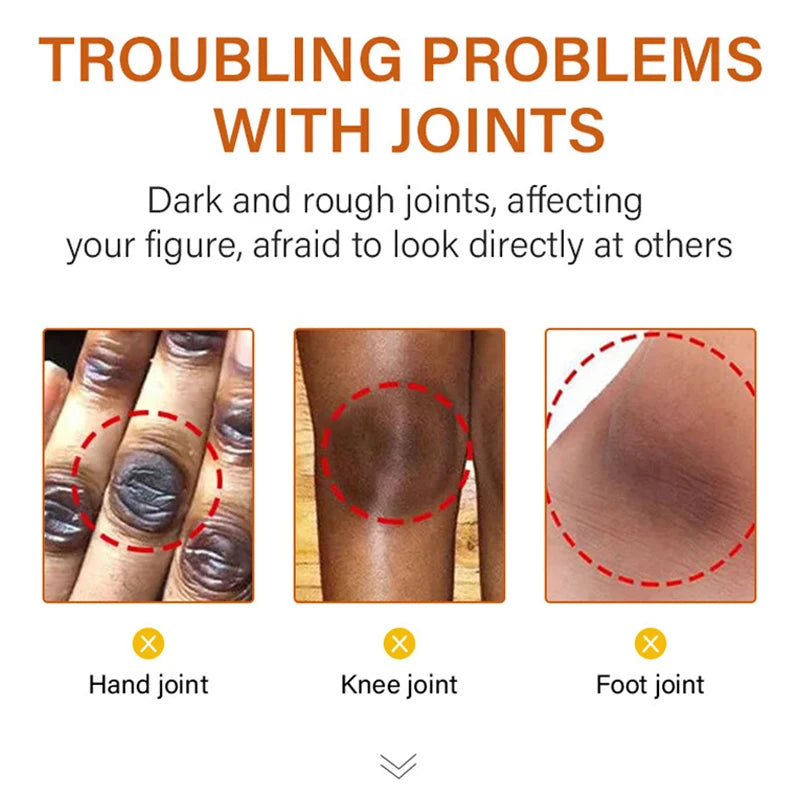 Dark Knuckles Fast Whitening Serum Pigmentation Correctors for Black Skin Hand