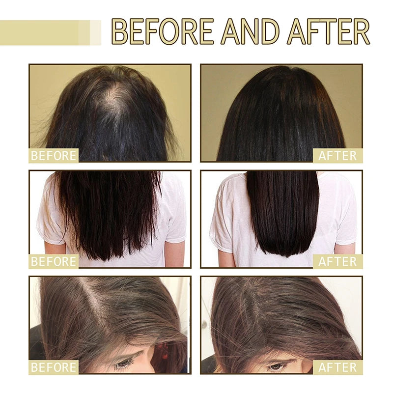 EELHOE Dense Hair Essential Oil Repairs Hair Damage Prevents Hair Loss Softens Nourishes Hair Nourishes Hair Essence Oil Health