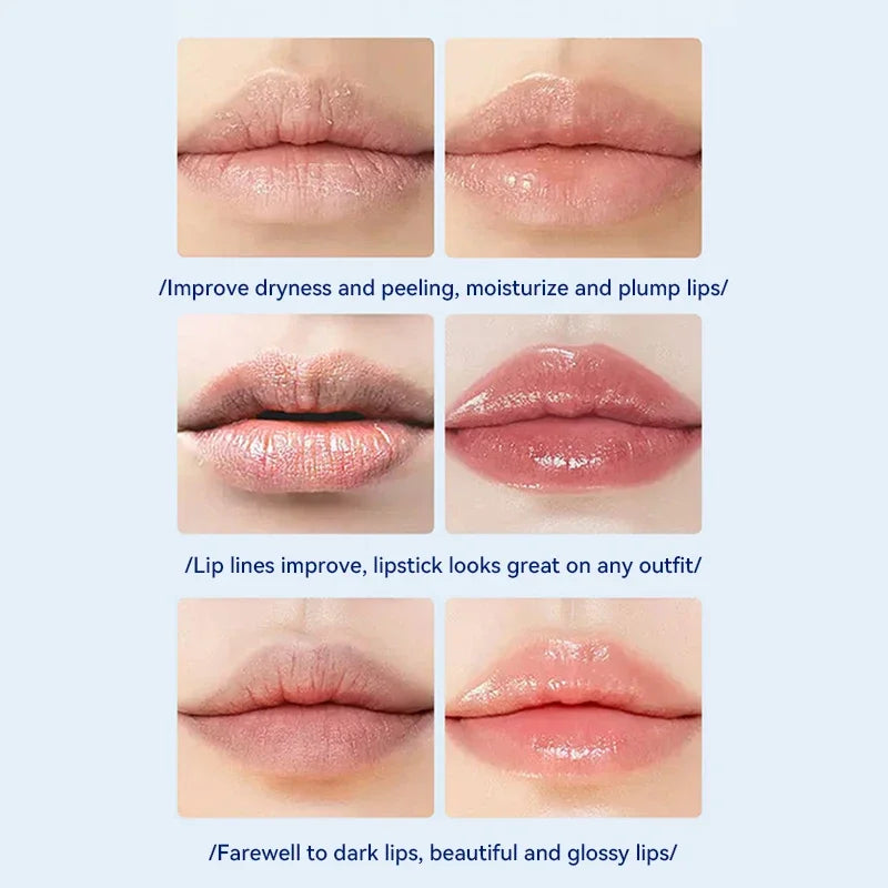 Lip Balm Remove Dark Pigment Lightening Moisturizing Cream Hyaluronic Acid Exfoliating Dead Skin Whitening Beauty Health Care