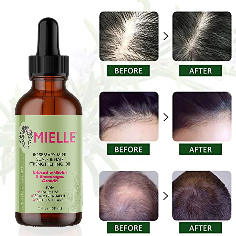 Hair Growth Essential Oil Rosemary Mint Hair Strengthening Oil Nourishing Treatment for Split Ends and Dry Mielle Organics Hair