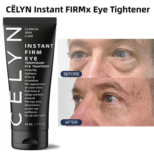 Cëlyn Make Up Eye Firmer Eye Lift Firm Eye Bag Removal Wrinkle Removal Eye Care Eye Cream Remover Dark Circle  Eye Pouches
